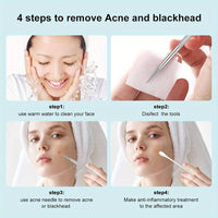 Stainless Steel Unscented Extraction 3pcs Tools, Blackhead & Blemish for