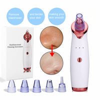 Electric Blackhead Remover Vacuum Suction Kit USB Rechargeable Portable Face