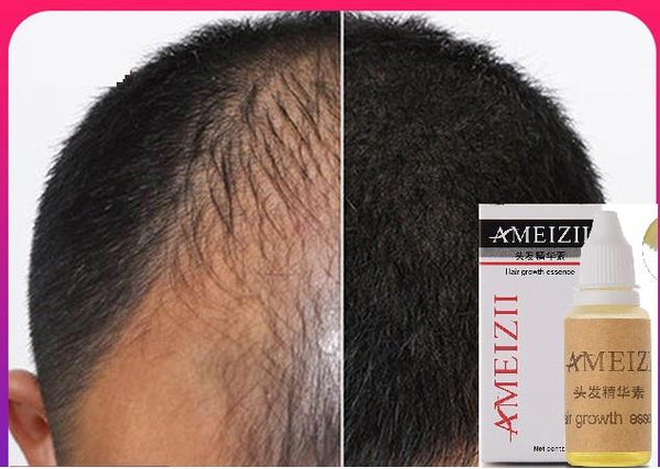 Best Japanese Hair Growth Serum 100% Pure Natural for Hair Loss Treatment