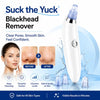 Suck and Yuck Blackhaed Remover Portable Blackhead Remover Tool