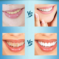 Teeth Whitening Powder for Oral Hygiene with 100% Micronized Activated
