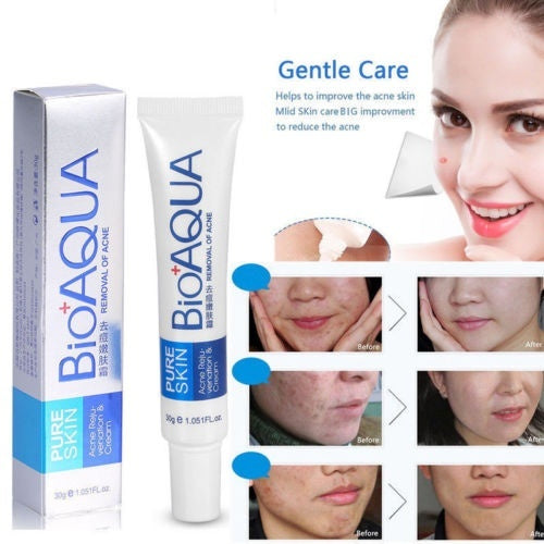Bioaqua Removal of Acne Cream Pimple Bio Aqua 30g