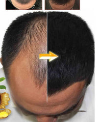 Lanthome Moroccon Oil for Hair Growth Restoration and Hair Loss Prevention