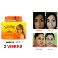 Carotone Black Spot Corrector Cream 30ml