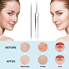 Stainless Steel Unscented Extraction 3pcs Tools, Blackhead & Blemish for