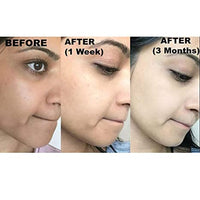 Skin Solution Store Kojie San Soap 135g